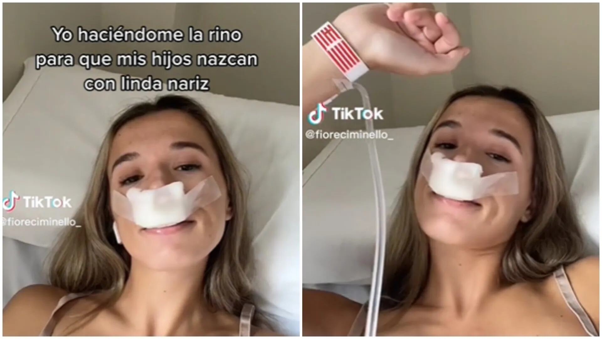 Una tiktoker argentina se operó para que sus hijos “nazcan con una linda nariz” y desató un aluvión de burlas