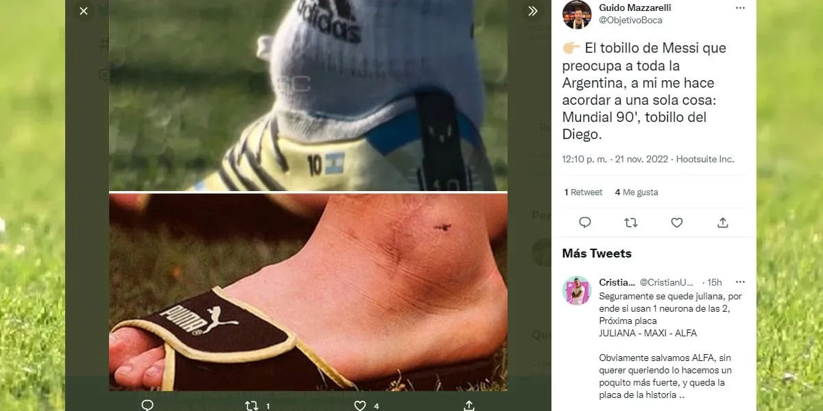 Se filtró una foto de Lionel Messi con el tobillo hinchado y los memes salieron con los tapones de punta