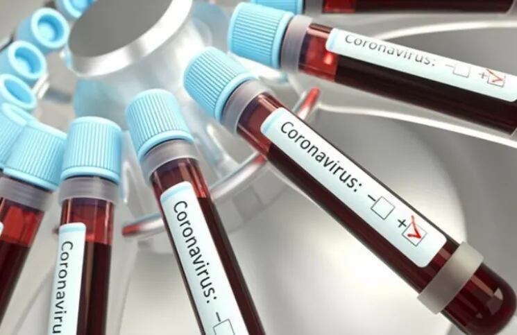 Coronavirus | Aseguran que los anticuerpos del Covid-19 no durarían mucho en los asintomáticos