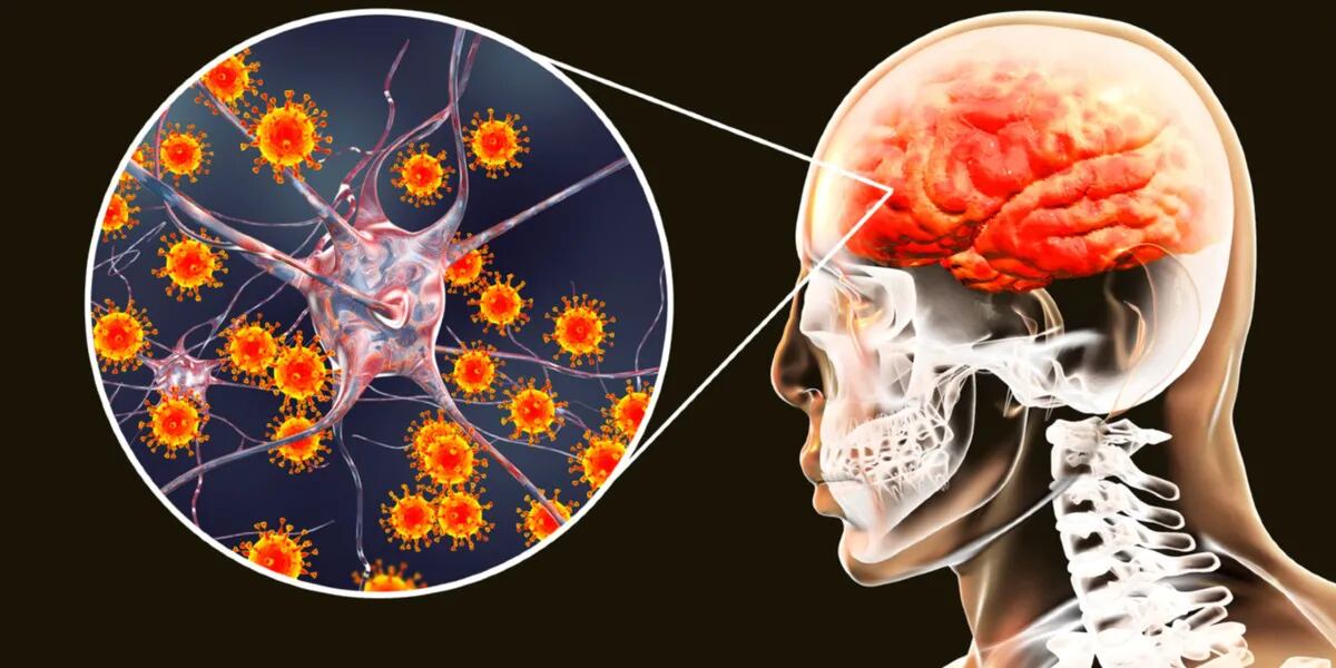 Afirman que los casos leves de coronavirus podrían acelerar el envejecimiento cerebral