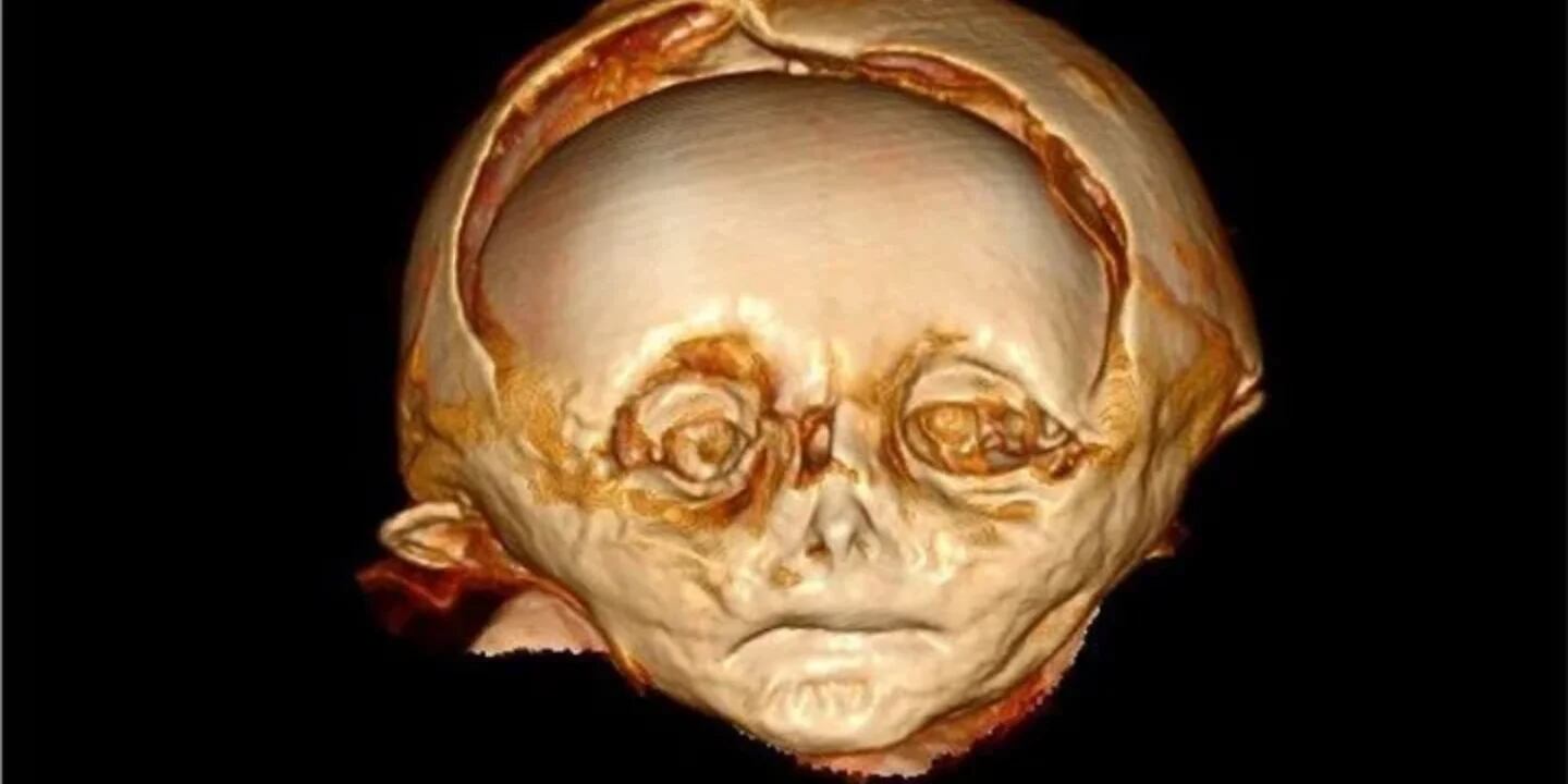 Increíble hallazgo de un bebé momificado que habría muerto por falta de exposición a la luz solar