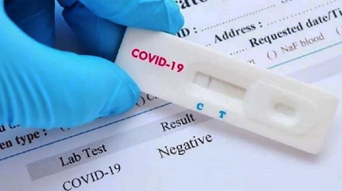 La ANMAT aprobó los autotest de coronavirus 