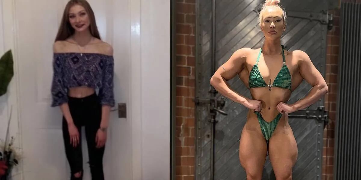 Sobrevivió a la anorexia, llegó a pesar 5 kilos y ahora transformó su cuerpo: “El fisicoculturismo me salvó la vida”