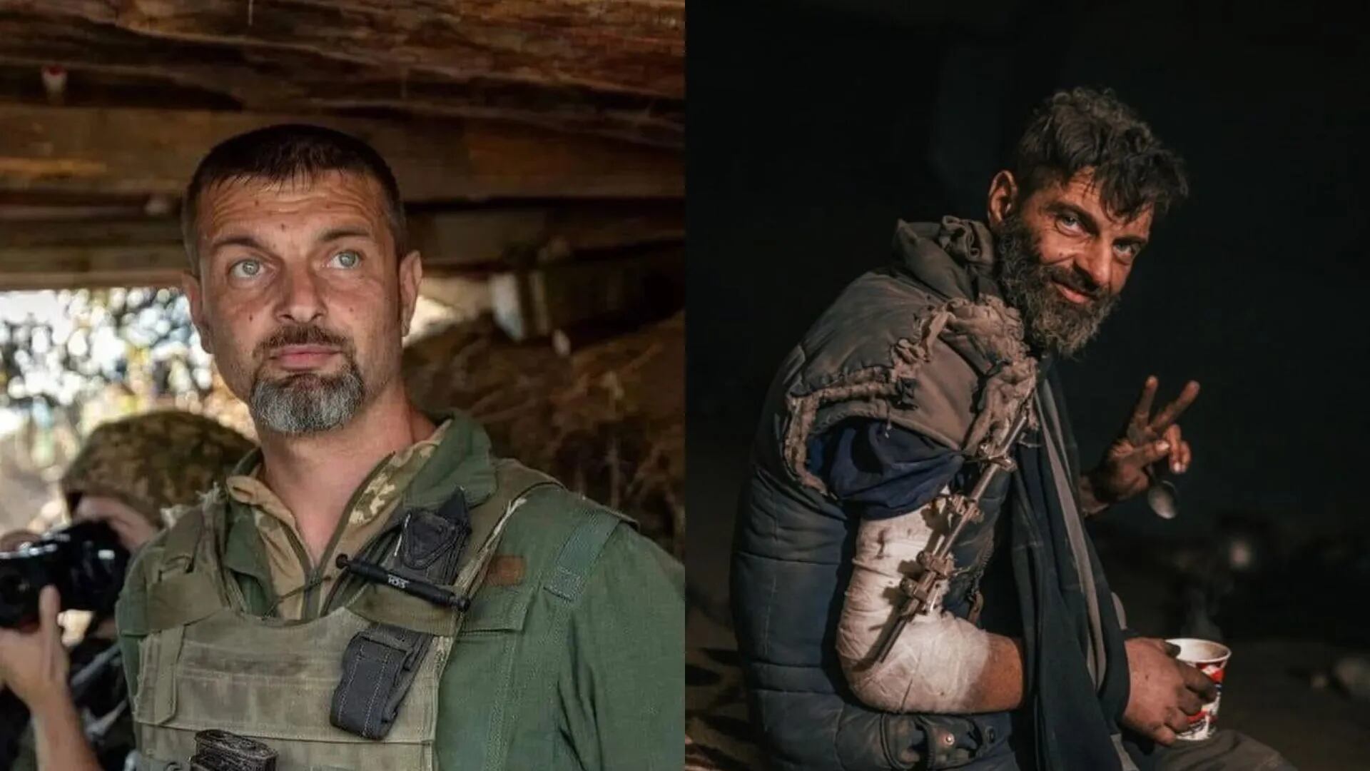 El escalofriante antes y después de un soldado ucraniano que sobrevivió al cautiverio ruso: “Hay mucho por hacer”