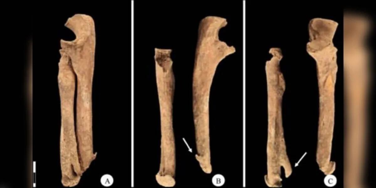 Encontraron los restos de un hombre medieval que tenía un cuchillo en reemplazo de su mano amputada