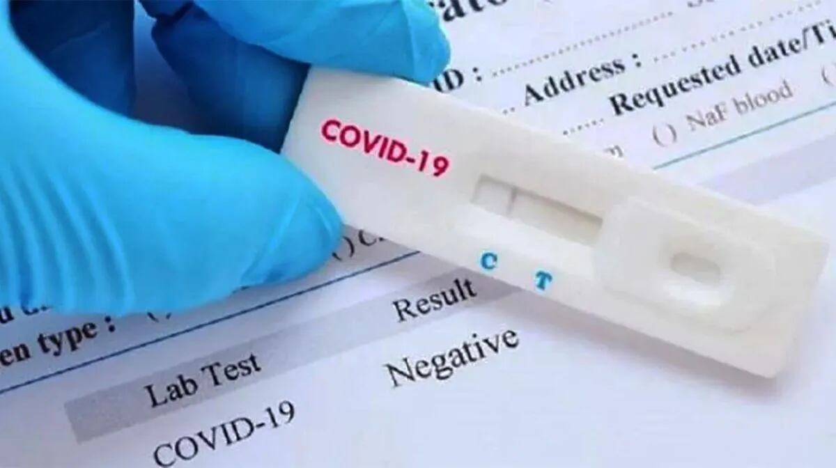 La ANMAT aprobó los autotest de coronavirus
