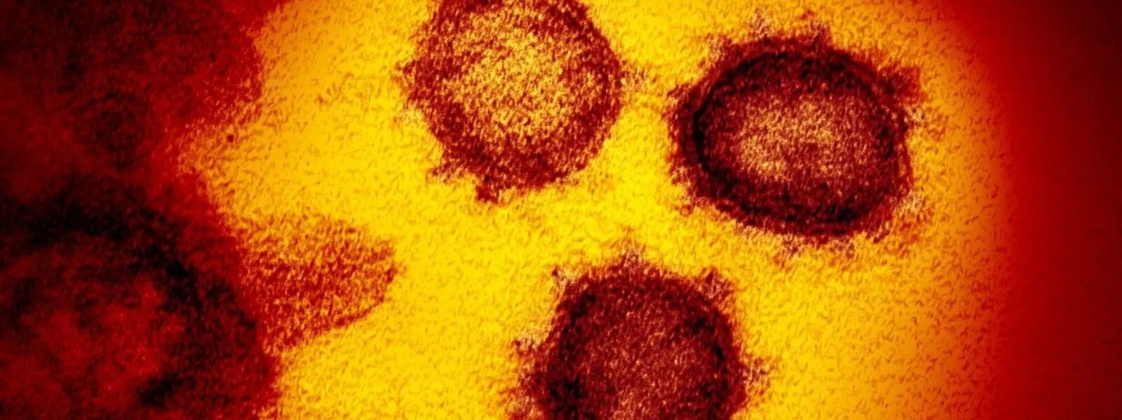 Coronavirus: cómo es la nueva cepa japonesa que sería resistente a las vacunas