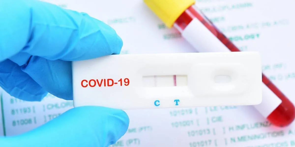 LA ANMAT prohibió un test de diagnóstico rápido de coronavirus por estar “falsificado”