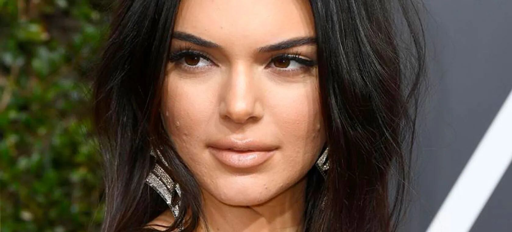 Kendall Jenner enfrentó a los que criticaron su acné en los Golden Globes