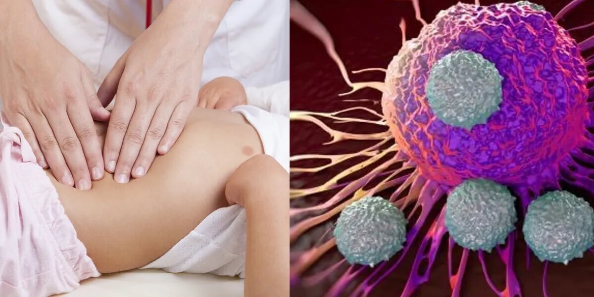Hepatitis aguda infantil: una hipótesis relaciona la enfermedad a un “superantígeno” del coronavirus