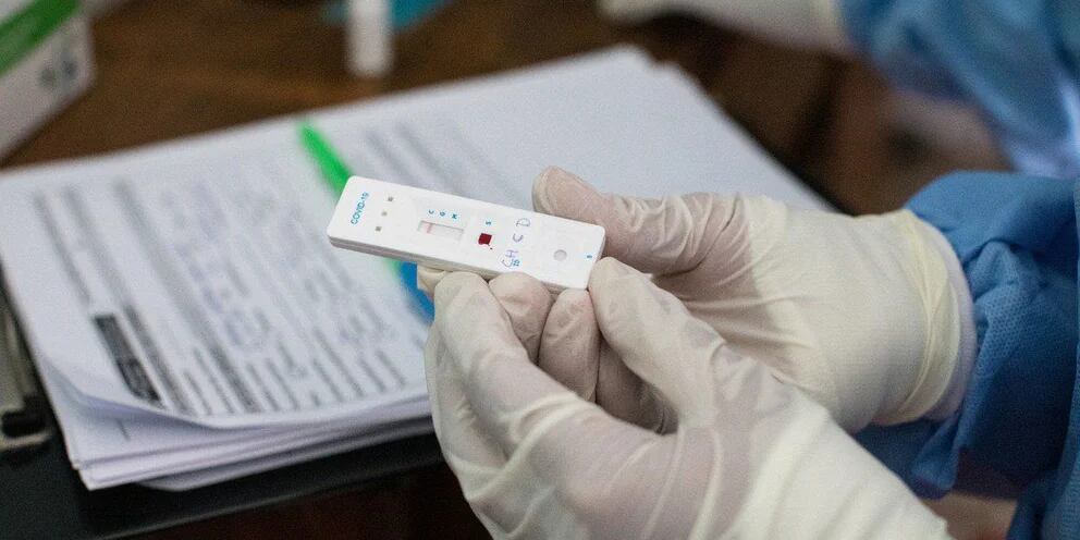 El Gobierno busca que las farmacias informen sobre los resultados positivos de los autotest de coronavirus