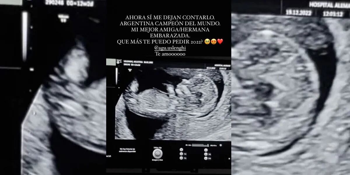 La China Suárez anunció un sorpresivo embarazo : “Ahora sí”