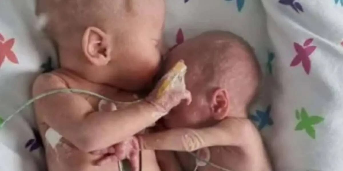 El conmovedor abrazo de dos gemelos que habían sido separados al nacer