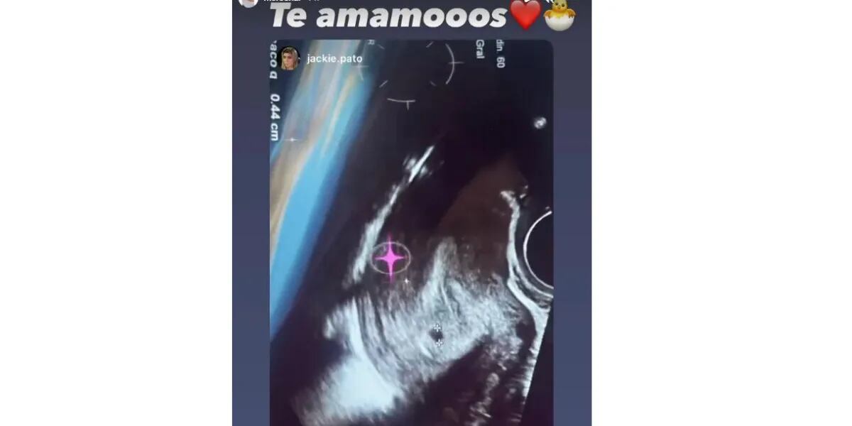 Morena Rial mostró la primera ecografía de su bebé: “Te amamos”