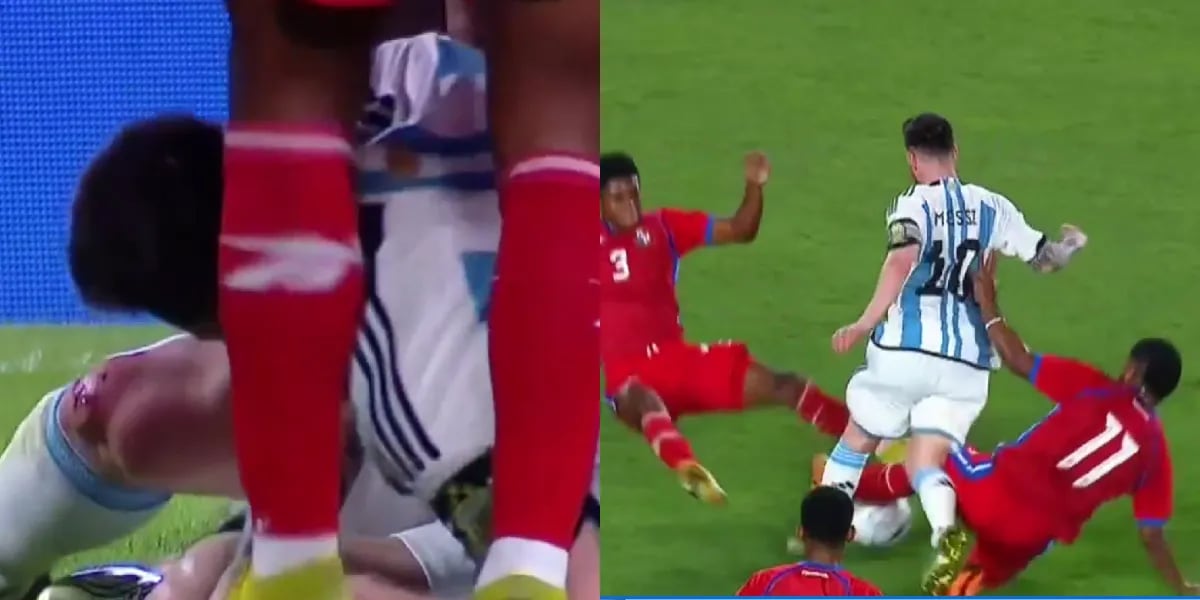 Lionel Messi recibió una brutal patada en el amistoso contra Panamá y quedó sangrando