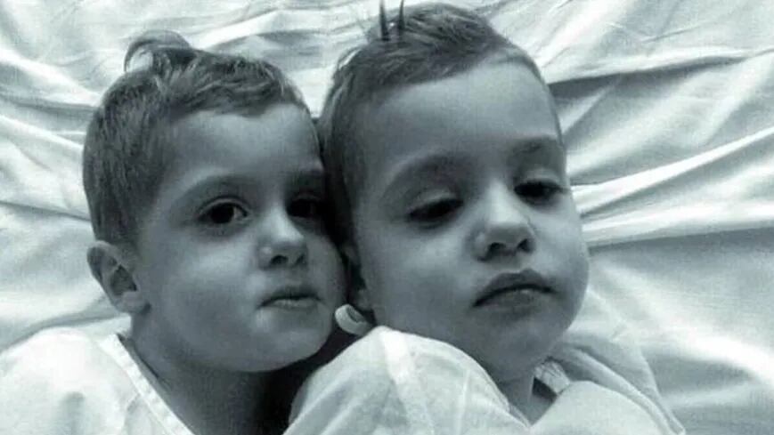 Eran gemelos, padecían una rara enfermedad y fallecieron con un mes de diferencia