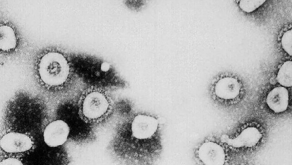 El extraño caso del hombre con "superanticuperpos" contra el coronavirus