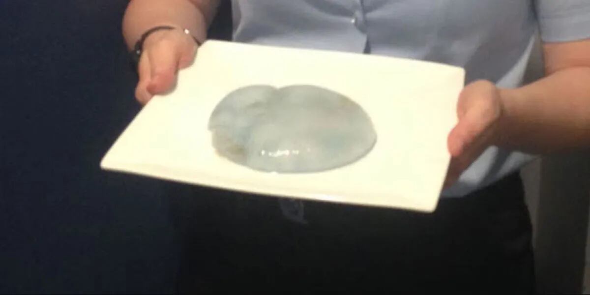 Creyeron que habían encontrado una medusa en la playa pero era un implante mamario