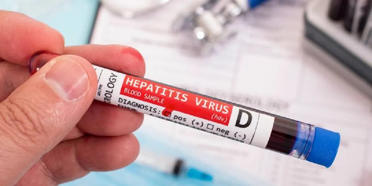 Murió el primer nene a causa de la hepatitis aguda de origen desconocido: cuáles son los síntomas según la OMS