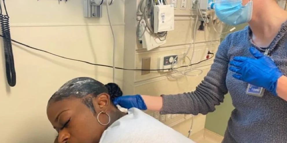 "Fue una mala idea", una influencer usó pegamento en vez de laca para el pelo y terminó en el hospital