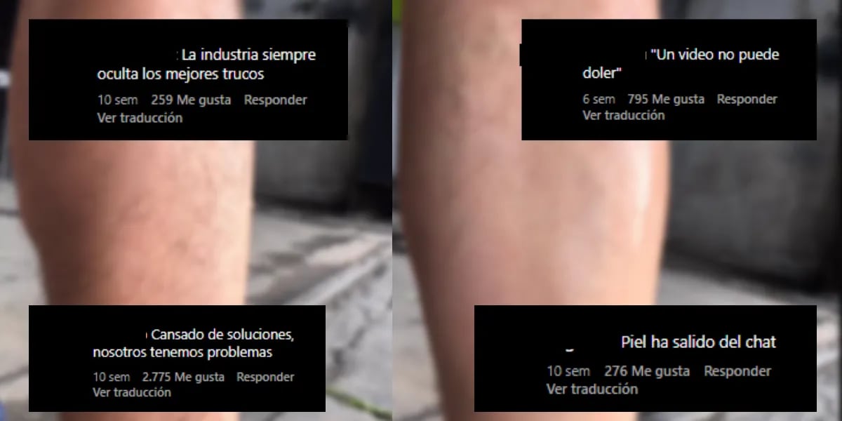 Video: encontraron un nuevo método para "depilarse" y se volvió viral en las redes