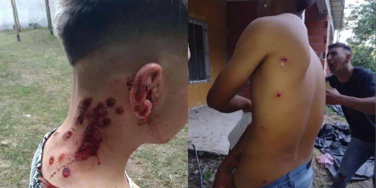 Oficiales de la Policía bonaerense dispararon con balas de goma a 11 adolescentes en una fiesta: “Me tiró de frente”