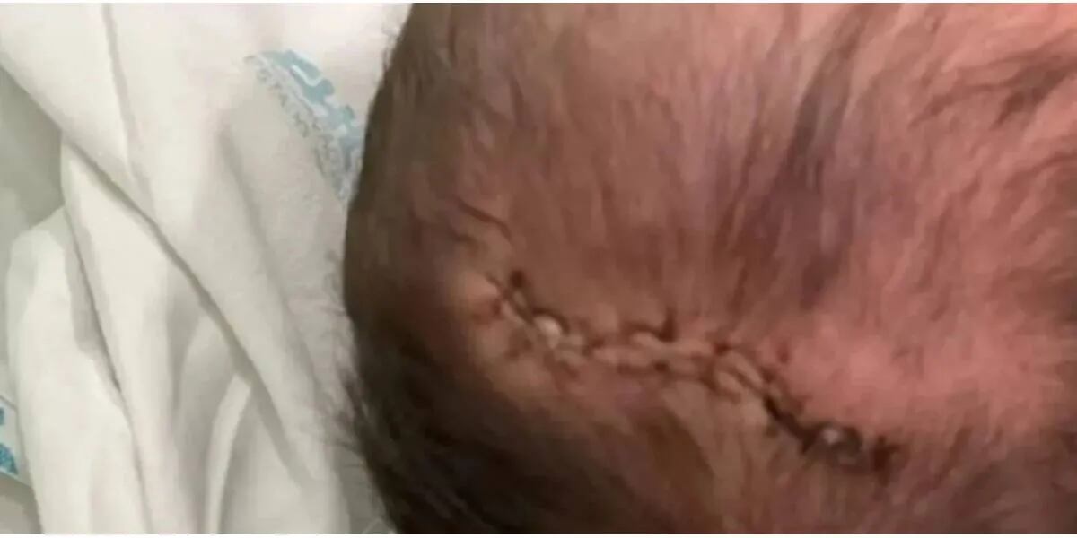 Una beba recién nacida recibió 11 puntos de sutura tras caer al piso en el momento del parto